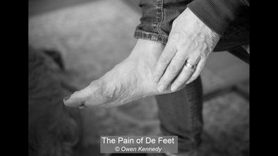 The Pain of De Feet