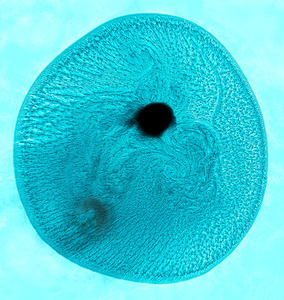 Single Cell - Ann Laverock