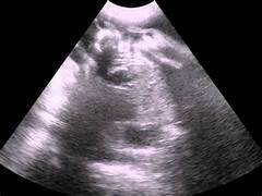 scanning
